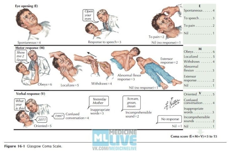 Кома информация. Головной мозг при коме. Тяжелая черепно мозговая травма Глазго.