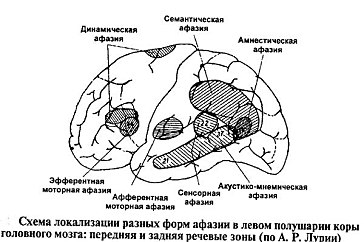 Грубая афферентная моторная афазия